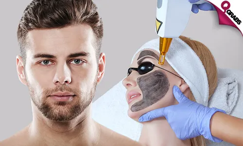 Carbon Laser Face Treatment with Consultation!
